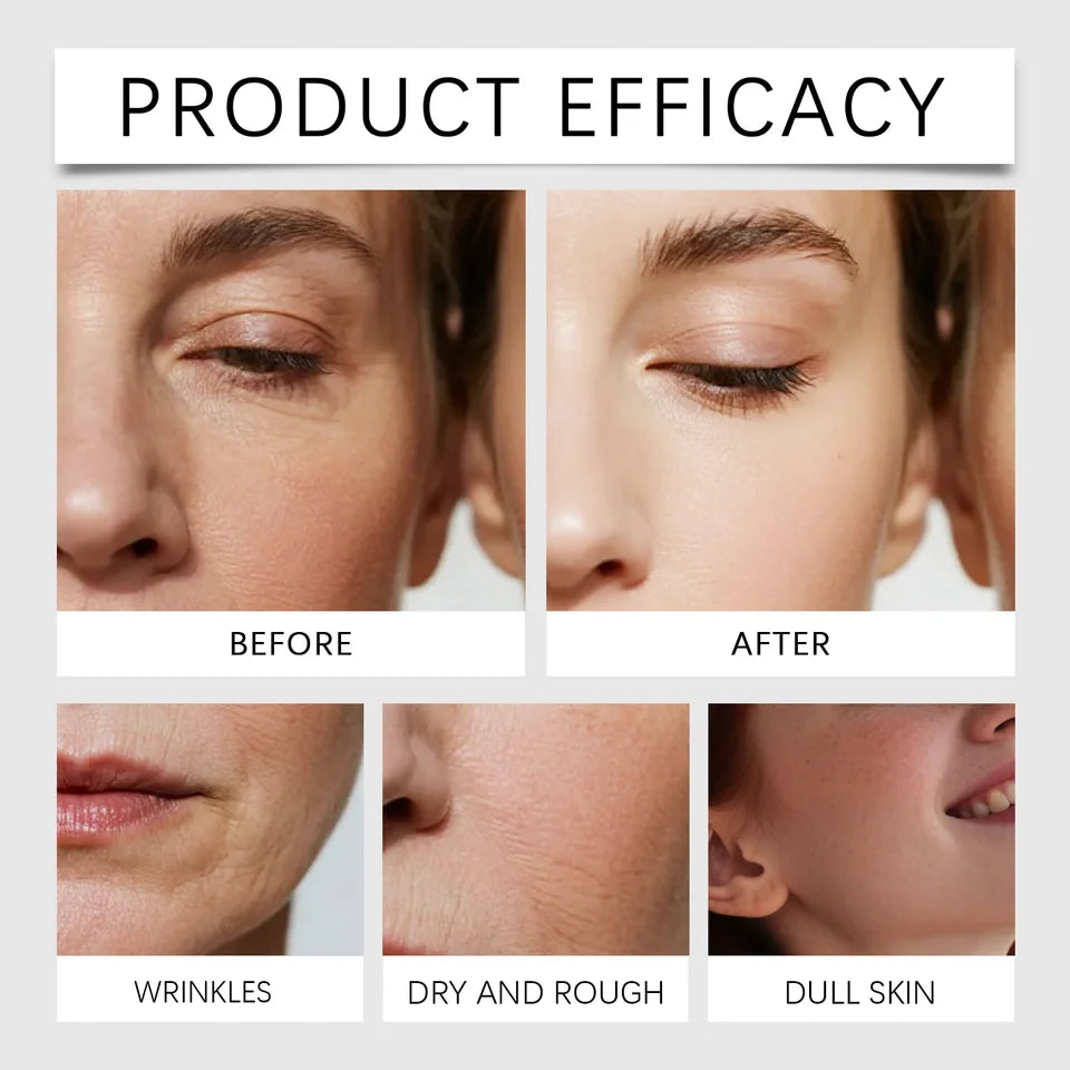 Upgrade Oligopeptide Face Skin Repair Micro Needle Serum Sensitive Skin Moisturizing and Smoothing Hyaluronic Acid Essence