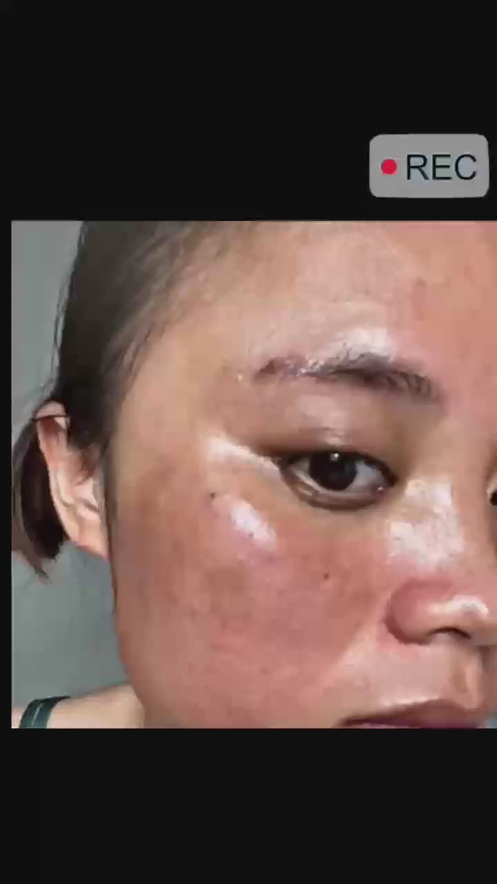Vitamin C Whitening Serum Remove Freckles Dark Spots Face Essence Fade Melasma Melanin Brighten Repair Dull Skin Care Cosmetics